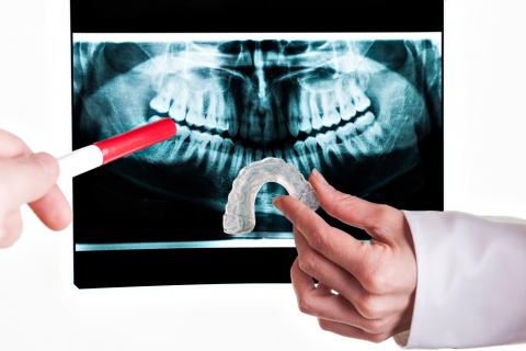 Un dentista sujeta una férula de descarga frente a una radiografía