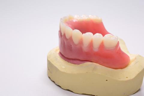 La resina, un material eficaz para reparar piezas dentales