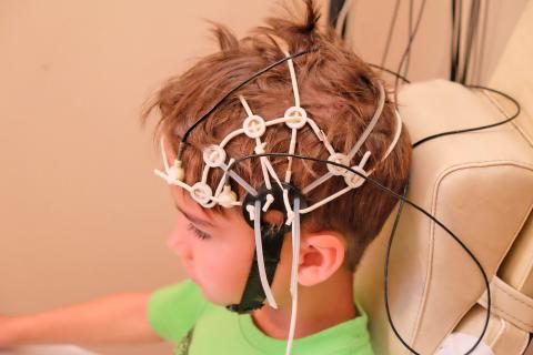 Niño con electrodos en el cerebro