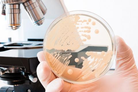 Bacterias en una muestra vaginal