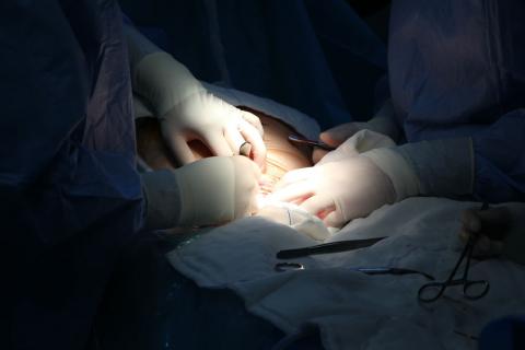 Practican un cateterismo a un feto en el vientre materno