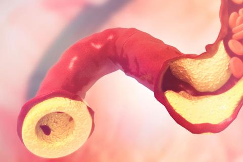 Ilustración 3D colesterol
