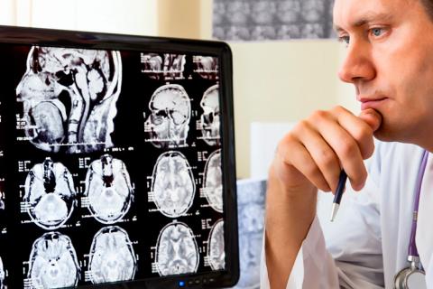 Médico visualizando un daño en el cerebro en unas radiografías