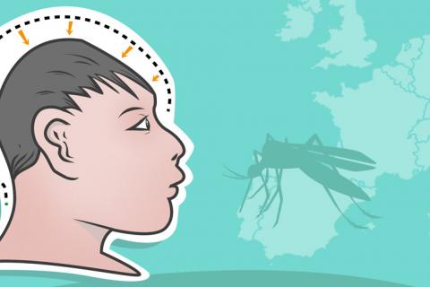 Primer feto con microcefalia por zika en España