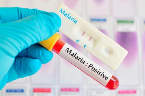 La malaria también puede deteriorar los huesos del paciente