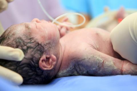 Nace el primer bebé gestado gracias al útero de una donante muerta