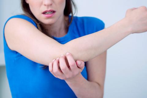 Una mujer con psoriasis se rasca el codo