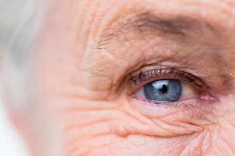 Mujer mayor con problemas capilares oculares