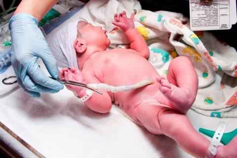 Un sanitario pinza el cordón umbilical a un recién nacido