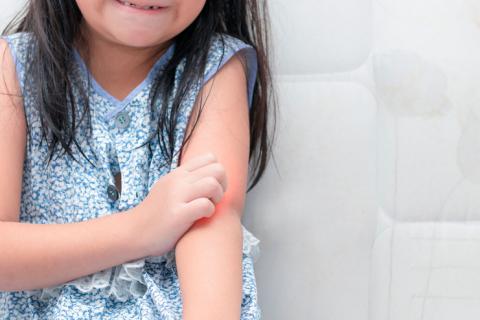 Diagnóstico, tratamiento y aceptación: el reto de la psoriasis infantil