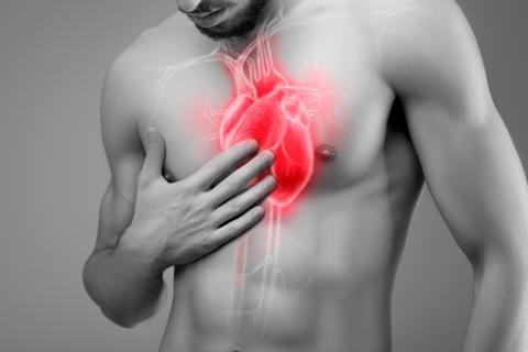 Riesgo cardiovascular en pacientes isquémicos
