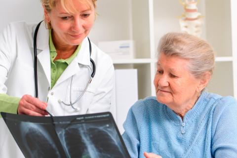 Mujer con osteoporosis y riesgo de fracturas