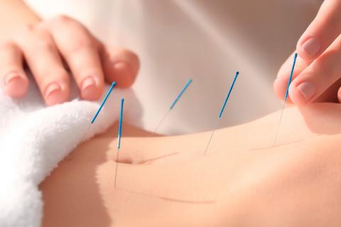 Técnicas de acupuntura