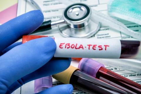 Test para detectar el ébola