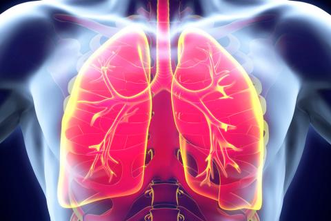 Ilustración de pulmones con bronquitis
