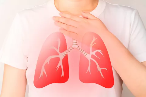 Persona con sarcoidosis en los pulmones