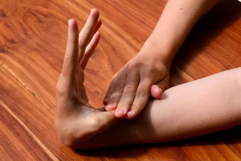 Una mujer que muestra la hipermovilidad articulatoria de su mano