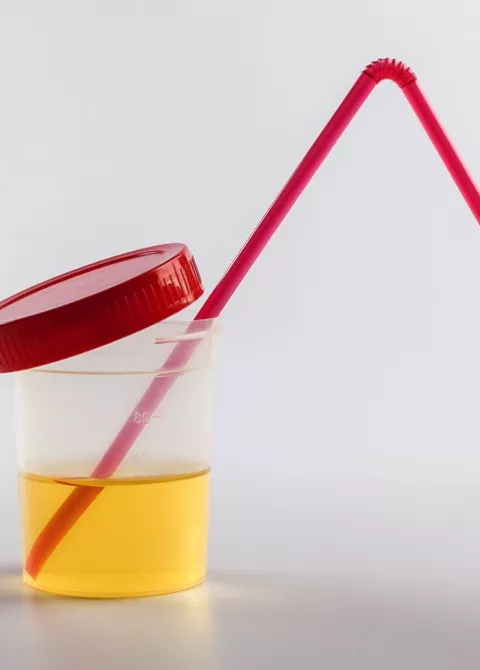Bote de orina con la tapa abierta y una pajita de plástico roja dentro
