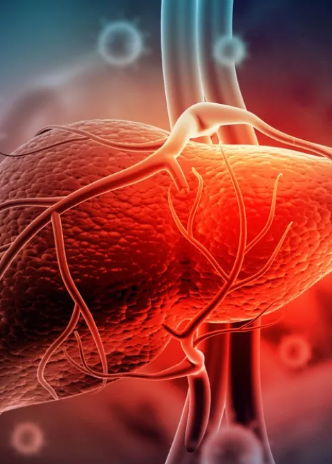 Virus de la hepatitis provocando un cáncer de hígado