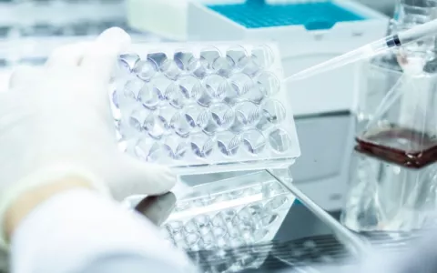 Análisis de cultivo celular en laboratorio Científico en laboratorio analiza un cultivo celular