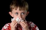 Niño con una hemorragia nasal