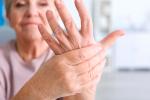 Consejos para pacientes con artritis reumatoide