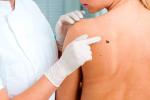 Una dermatóloga examina un lunar en la espalda de una paciente