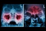 Radiografía diagnostica de la congestión nasal