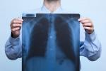 Diagnóstico de tromboembolismo pulmonar