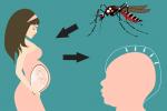Virus zika y microcefalia 