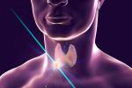 Nódulo en la tiroides