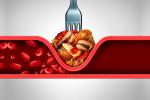 Ilustración que muestra una subida de triglicéridos al comer alimentos ricos en grasas