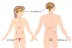 Causas del hipogonadismo Causas del hipogonadismo en la mujer y el hombre