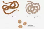 Causas de la teniasis Causas de la teniasis