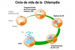 Causas del tracoma Causas del tracoma