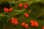 Causas de la uretritis