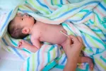 Síntomas de la onfalitis en el bebé