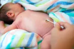 Cómo prevenir la onfalitis Cuidados del cordón umbilical del recién nacido