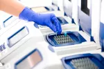 Diagnóstico de la fiebre hemorrágica de Crimea-Congo Test para detectar la fiebre hemorrágica de Crimea-Congo