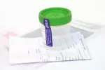 Diagnóstico de la incontinencia urinaria Análisis para la incontinencia urinaria