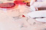 Diagnóstico de la leucemia Diagnóstico de la leucemia