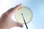 Diagnóstico de la listeriosis Diagnóstico de la listeriosis en laboratorio