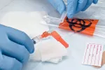 Diagnóstico en laboratorio del priapismo Diagnóstico del priapismo