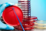 Diagnóstico de la salmonelosis Diagnóstico de la salmonelosis en un hemocultivo