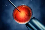 Microinyección intracitoplasmatica de espermatozoides Microinyección intracitoplasmatica de espermatozoides (ICSI)