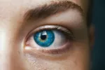 Síndrome de Waardenburg, ojos azul intenso Mujer con el ojo azul intenso