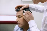 Preparación para un tricograma capilar El dermatólogo explora el cuero cabelludo de un paciente