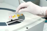 Pruebas médicas previas a una ligadura de trompas Pruebas previas a una ligadura de trompas
