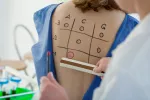 Resultados prueba alergia Resultados prueba alergia