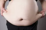 Síntomas del síndrome metabólico Obesidad abdominal
